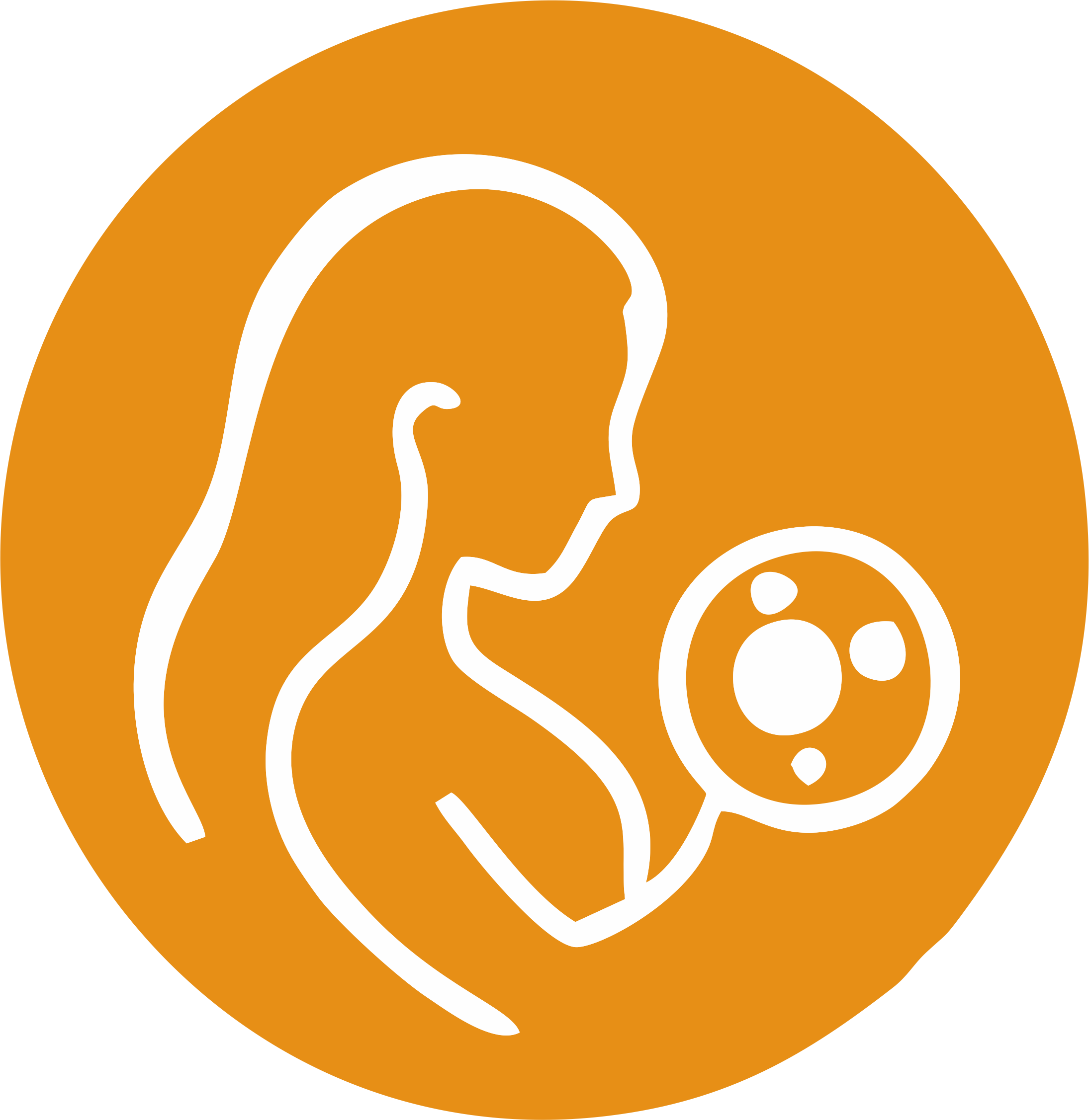 Infertility (IVF)